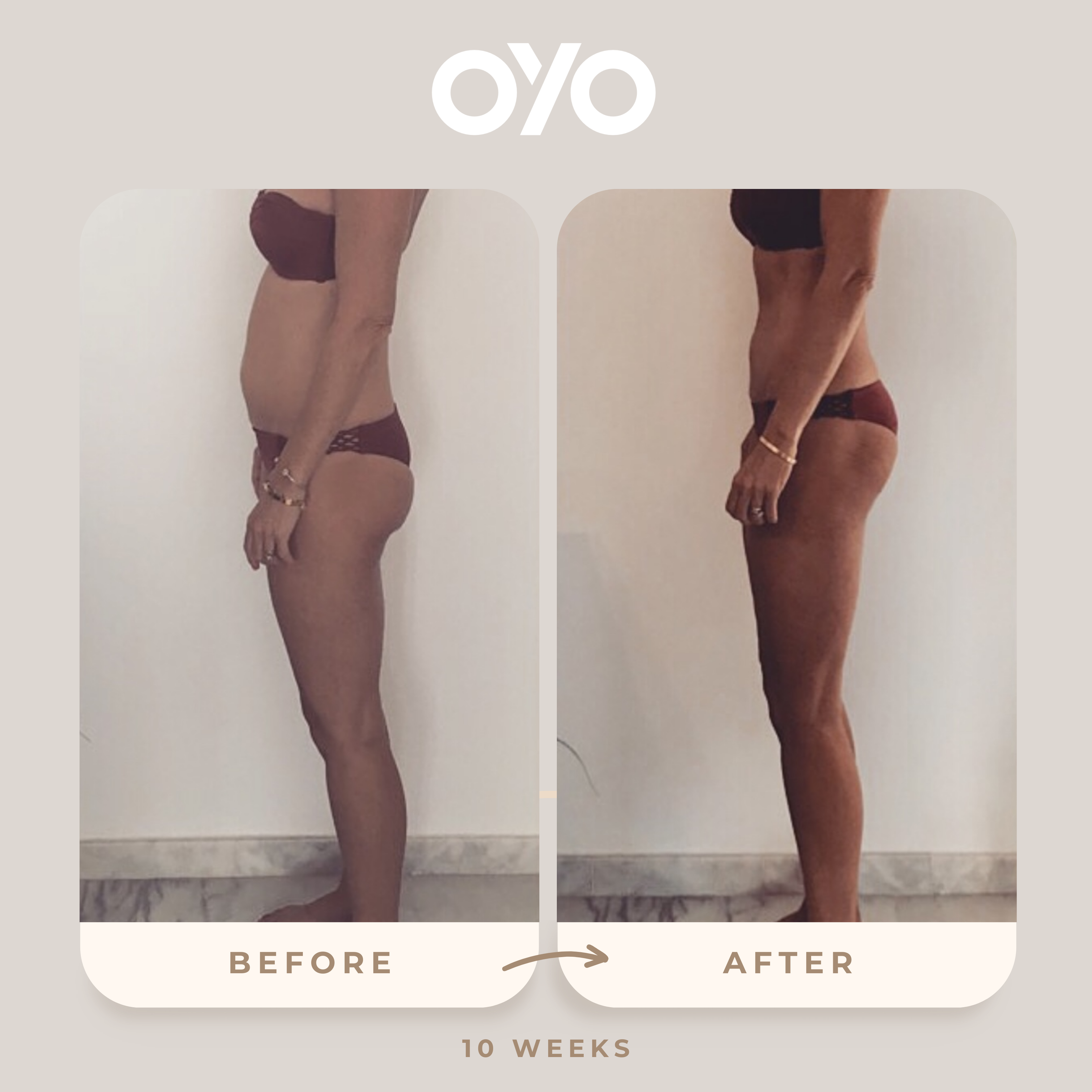 I absolutely LOVE the kit ! Can only recommend.