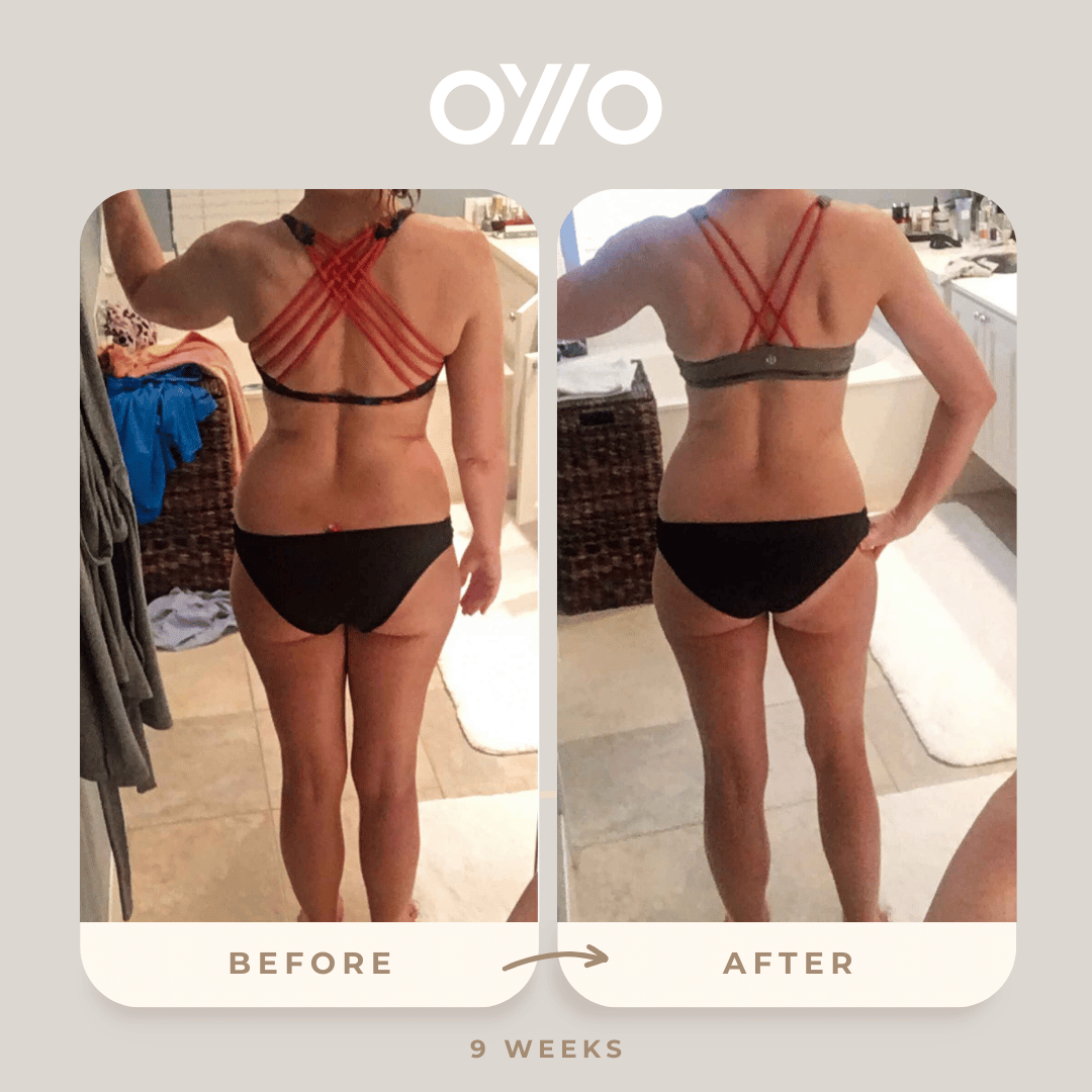 Love my OYIO Deluxe Kit.